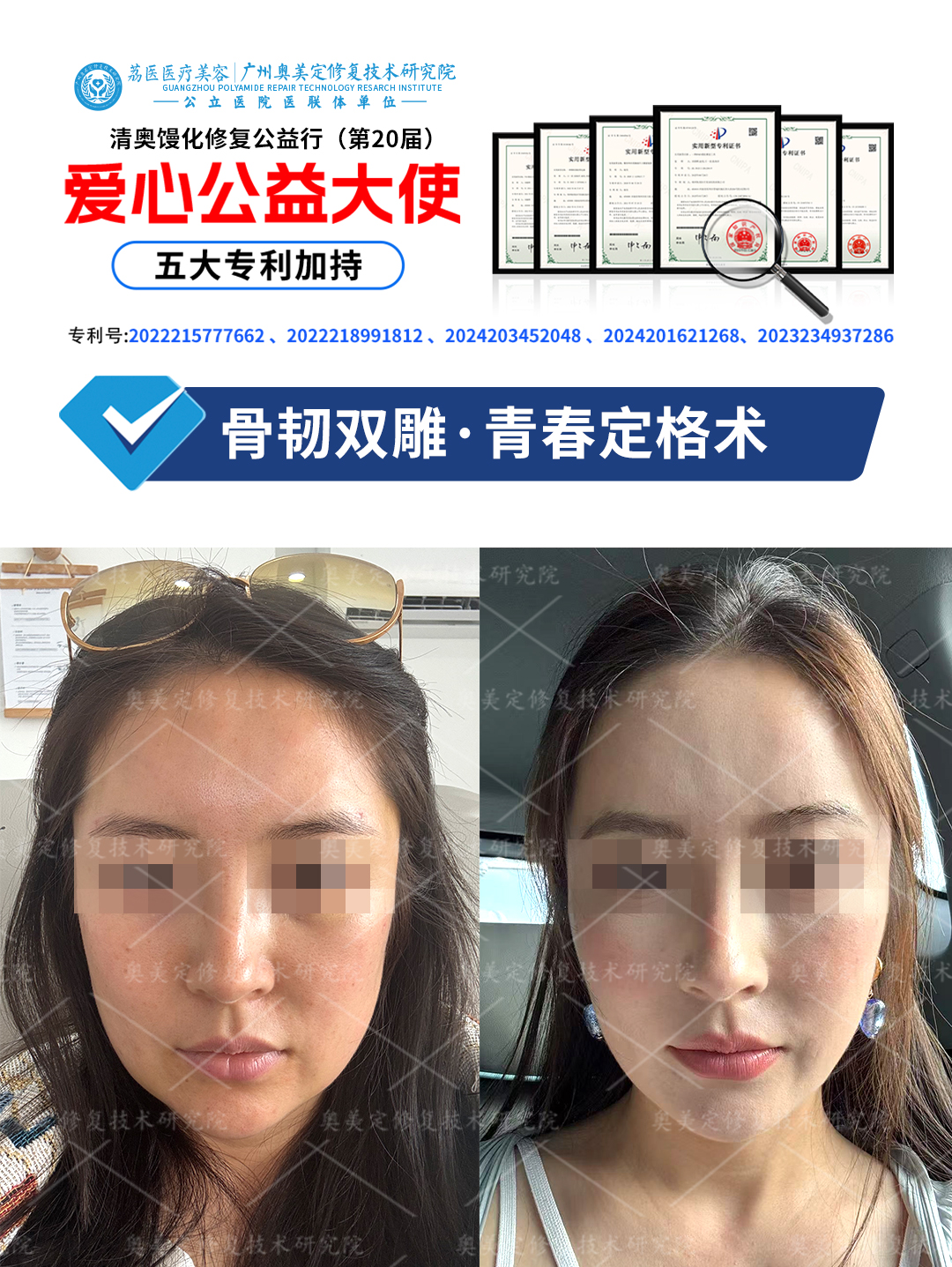 面部馒化后如何修复