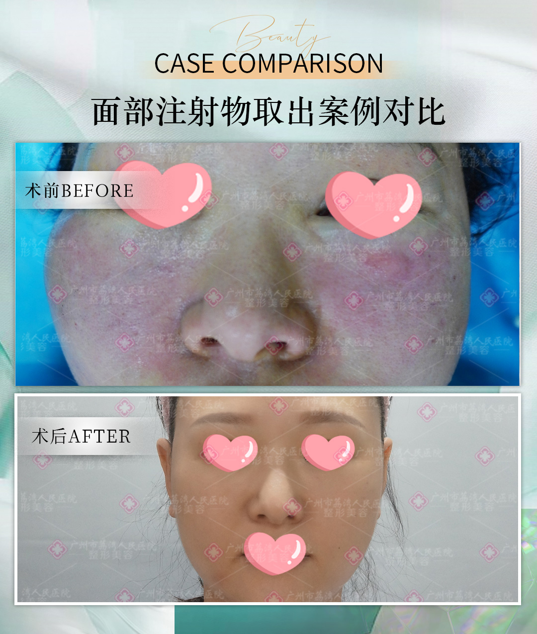 奥美定是什么东西？