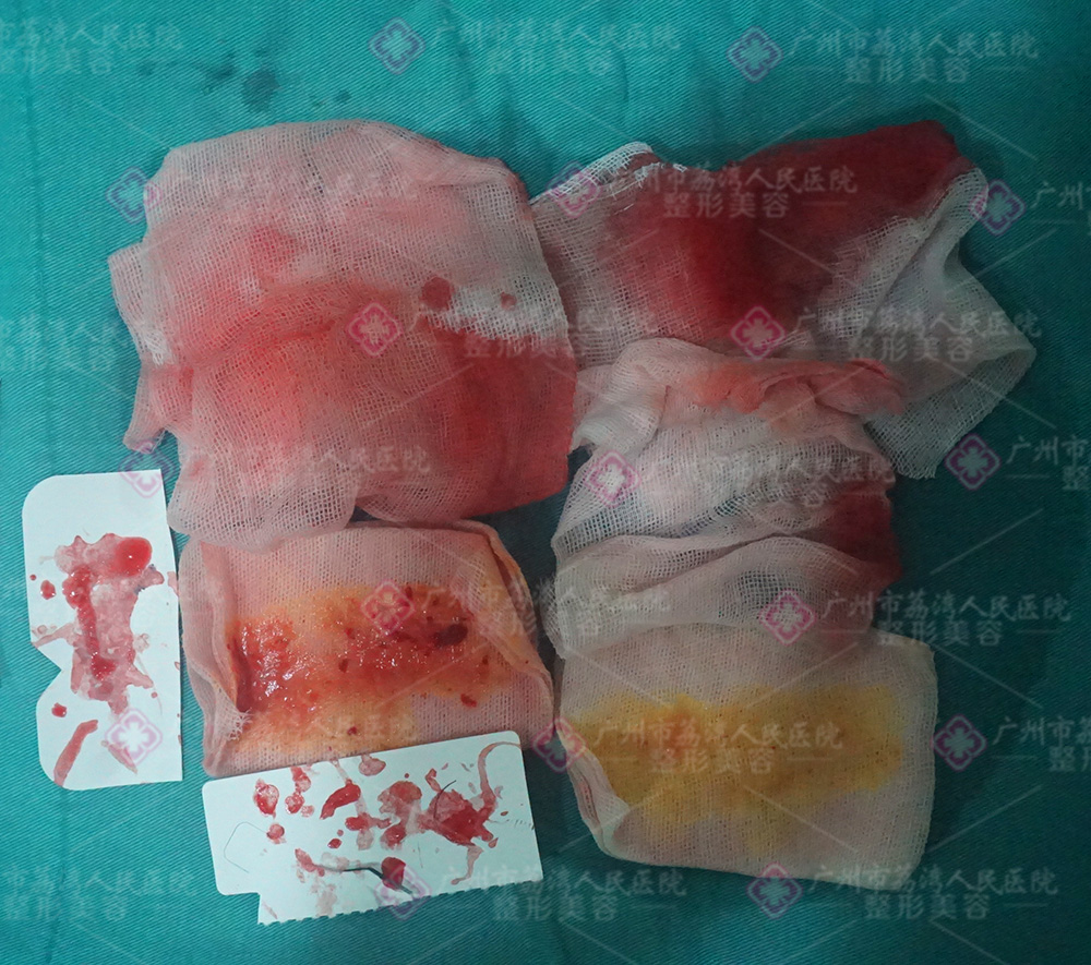 生长因子能不能通过溶解酶溶解呢